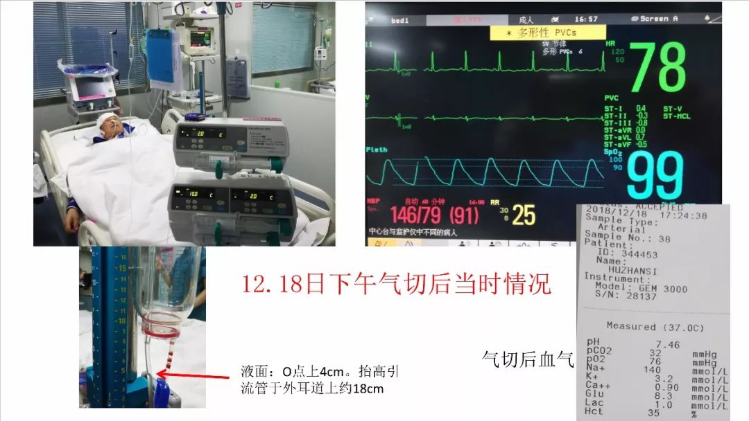 晒版机原理与互动策略评估探讨——基于V55.66.85版本的技术革新，功能性操作方案制定_Executive99.66.67